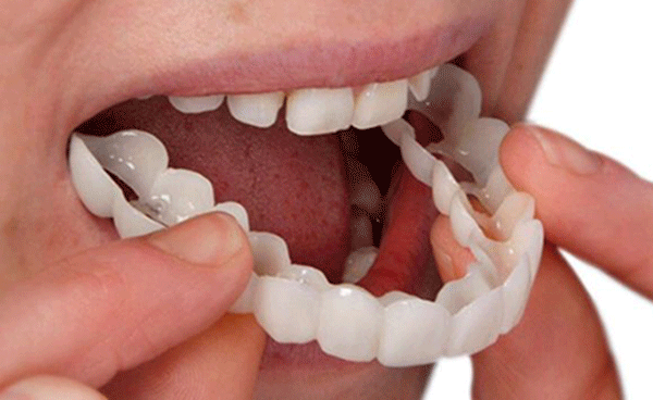 ساخت مواد دندانی با استفاده از عصاره گیاه آویش