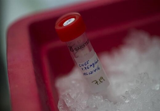 علت جدید برای فوت بیماران مبتلا به کرونا کشف شد