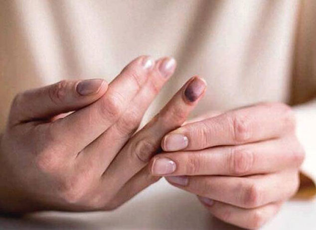 بی‌حسی و گزگز بدن برای چیست؟