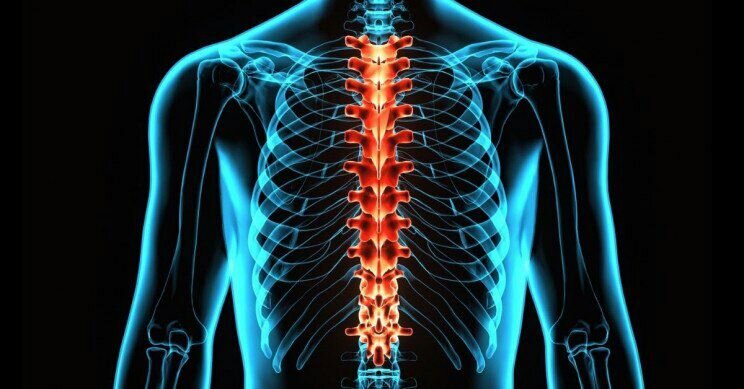 موفقیت پیوند سلول‌های بنیادی عصبی در آسیب‌های نخاعی