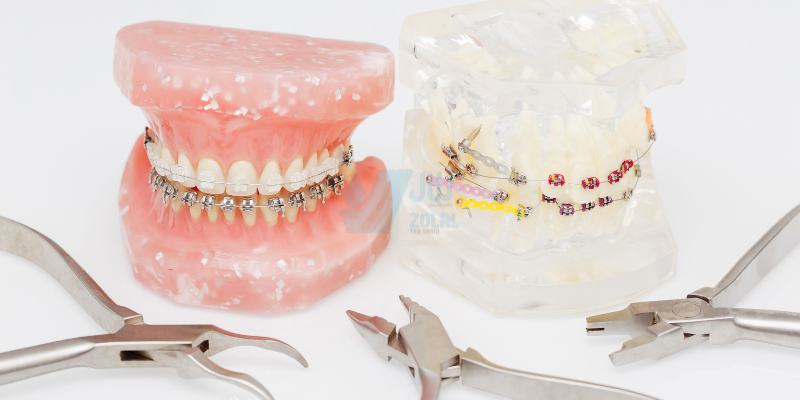 چه زمانی ارتودنسی کنیم؟ بررسی بهترین سن و شرایط برای شروع درمان ارتودنسی