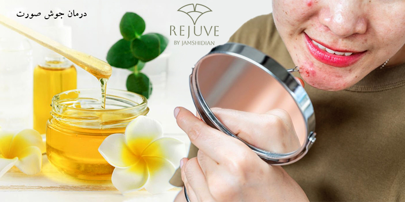 درمان جوش صورت در کلینیک زیبایی رژوه