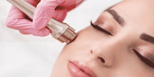 میکرودرم چیست و چه عوارضی دارد؟