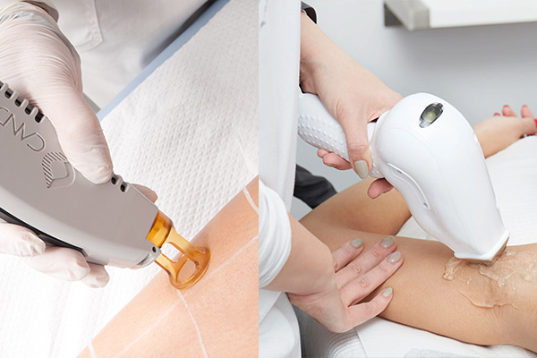 لیزر دایود بهتره یا الکساندرایت؟ مقایسه مزایا و معایب 2 دستگاه لیزر